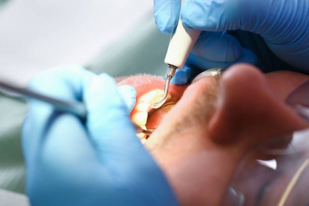 Best Emergency TMJ Treatment in Oceano, CA