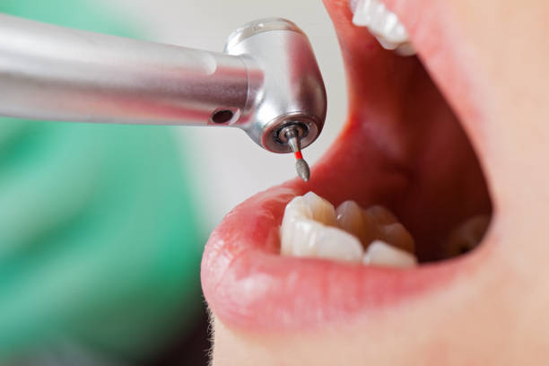 Best Cosmetic Emergency Dentistry in Oceano, CA